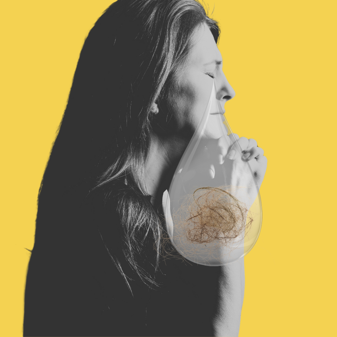 Alopecia support group – SoulUp